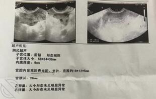 带妈妈去小诊所做流产